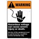 Hazardous Voltage Can Cause Severe Injury Or Death