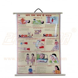 सेफ्टी चार्ट  आग तथा अन्य से जलना