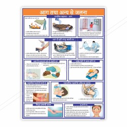 First Aid Of Fire Fighting Hindi Safety Chart| Protector FireSafety