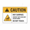 Hot Surface Contact With Skin May Burn Caution Sign| Protector FireSafety